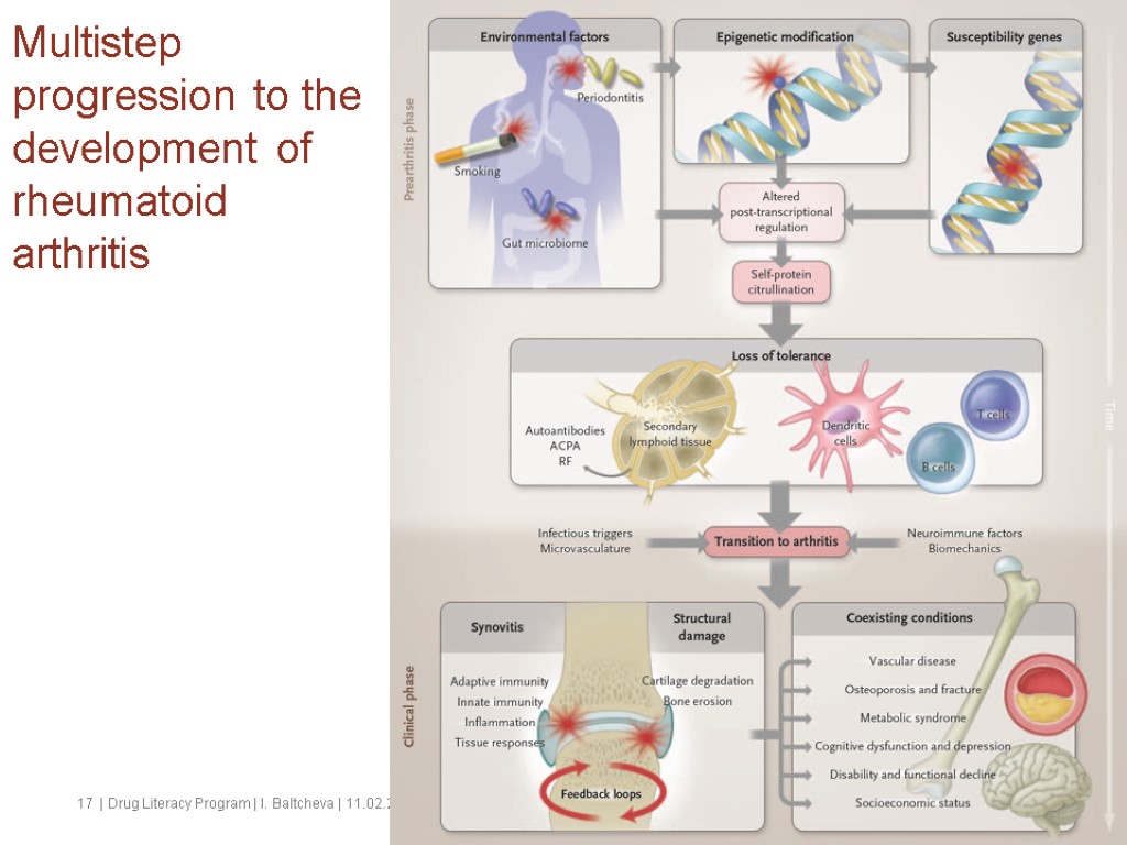 Multistep progression to the development of rheumatoid arthritis 17 | Drug Literacy Program |